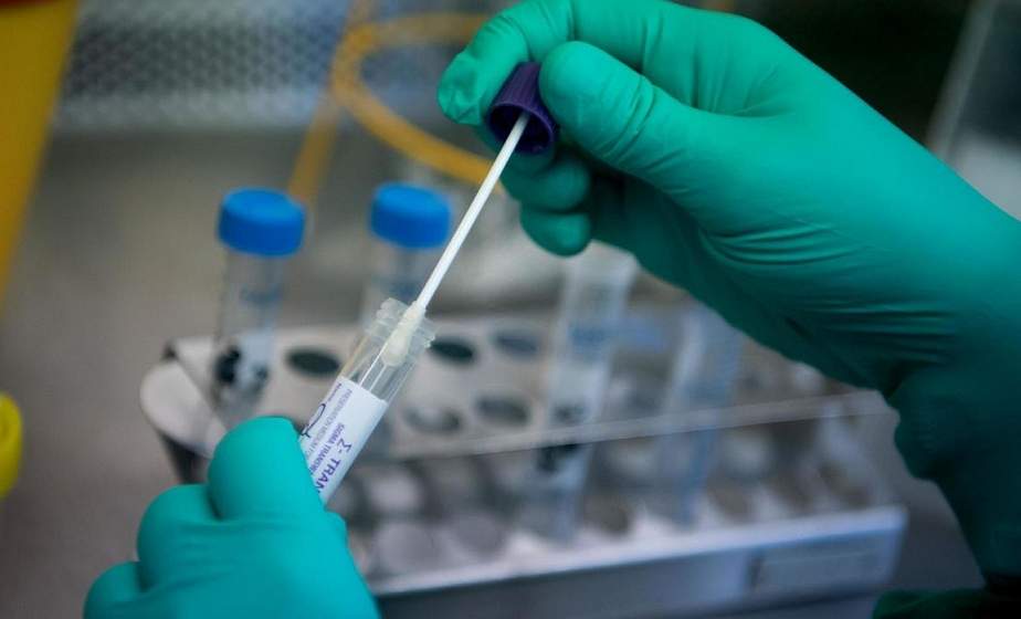Более 86,8 тыс. тестов на коронавирус провели в Беларуси